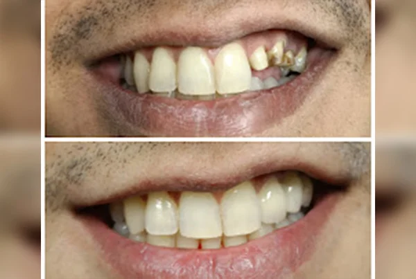Smile Gallery