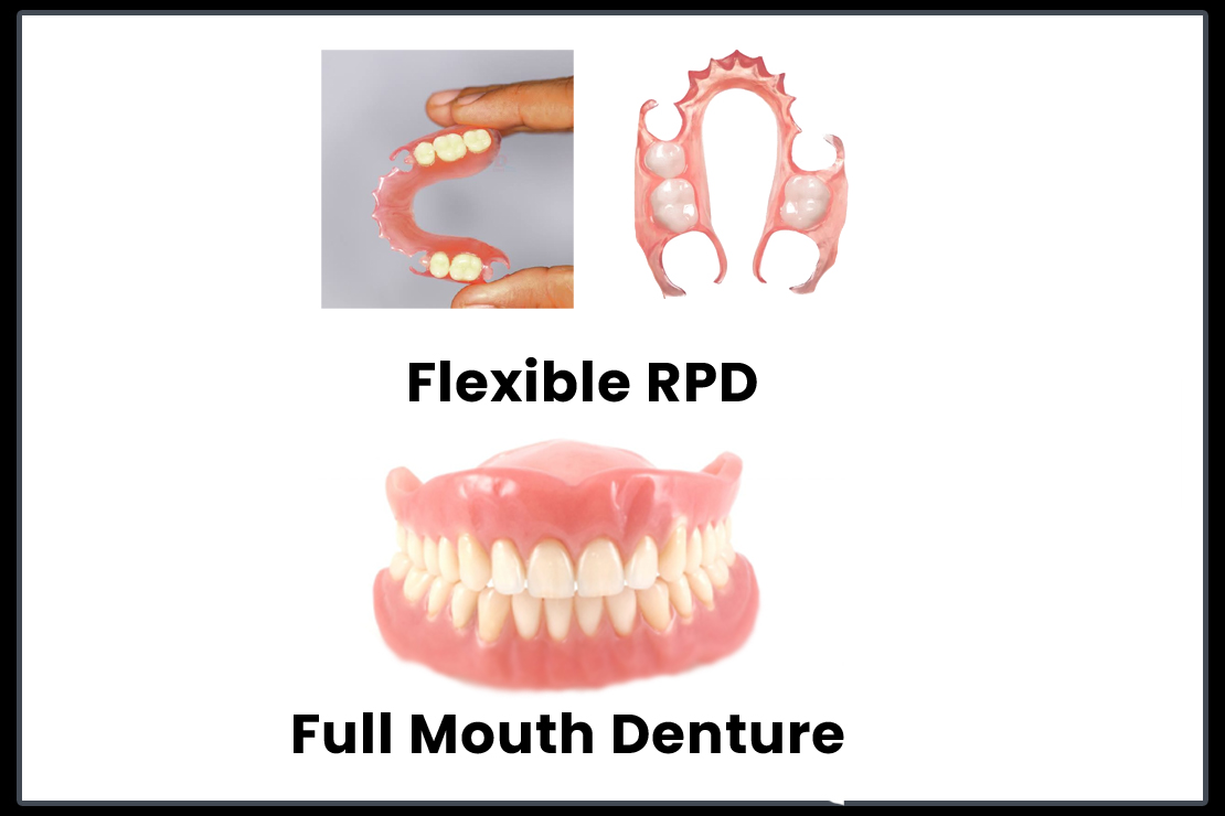 COMPLETE DENTURE