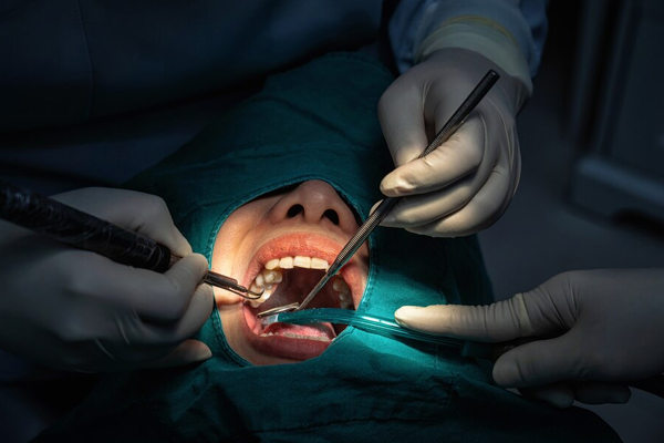 ORAL SURGERY