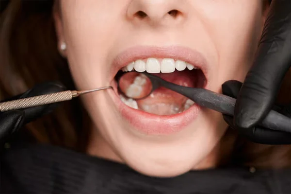 DENTAL RESTORATION FILLINGS AND TOOTH REPAIR